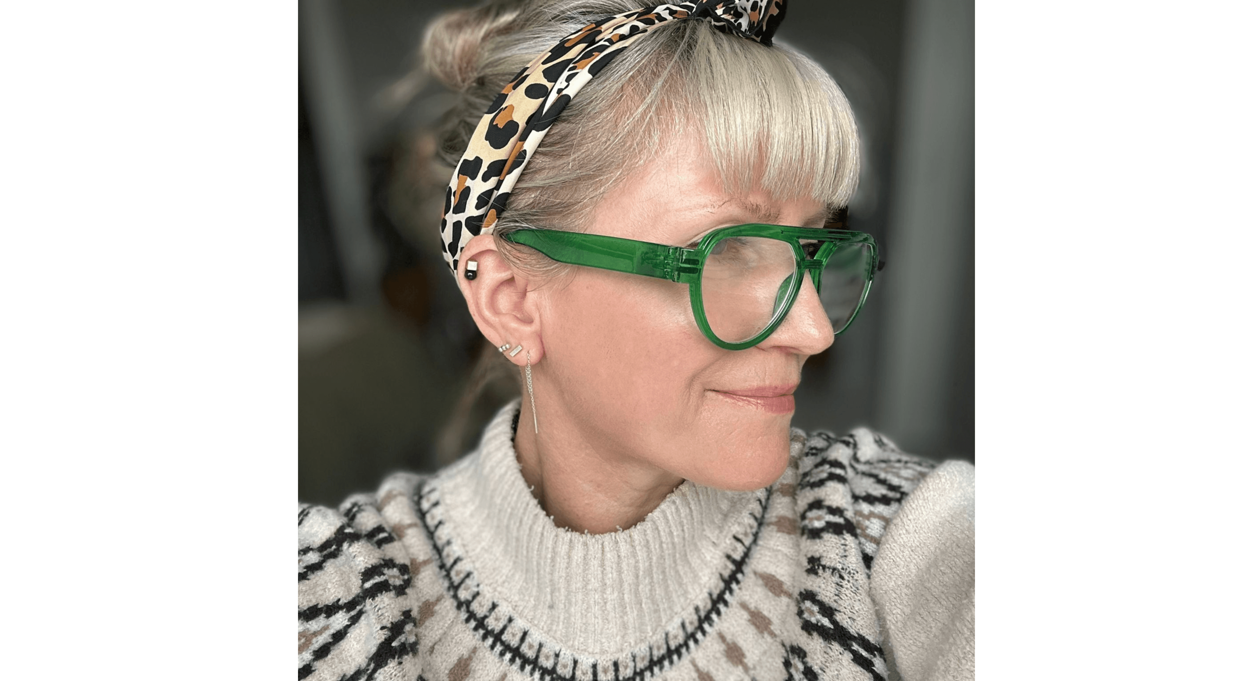 Results after Anti Redness Light