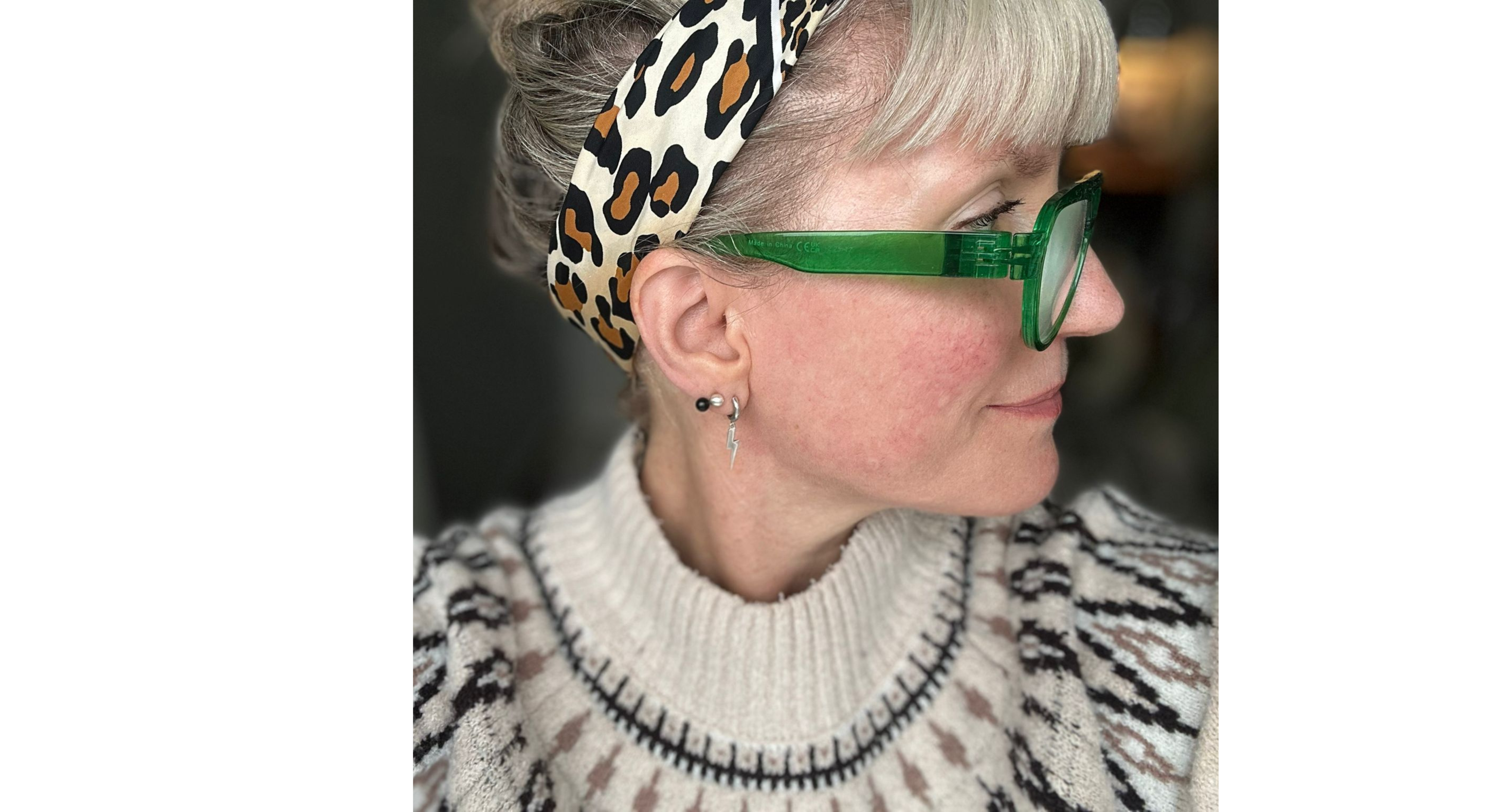 Tasha before applying Anti-Redness Light